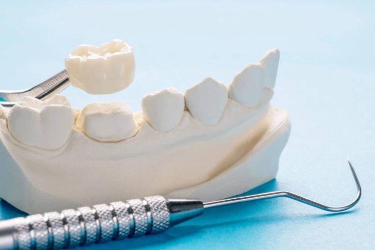 dentures in Markdale ON